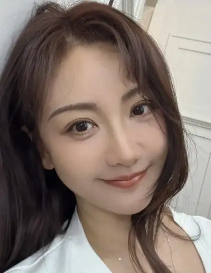 杨蓉面部烫伤恢复近照 皮肤白皙气色好