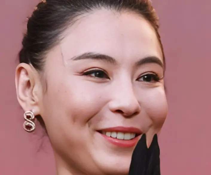 45岁张柏芝脸肿得离谱，苹果肌凸到挡鼻子，网友：医美做太急了