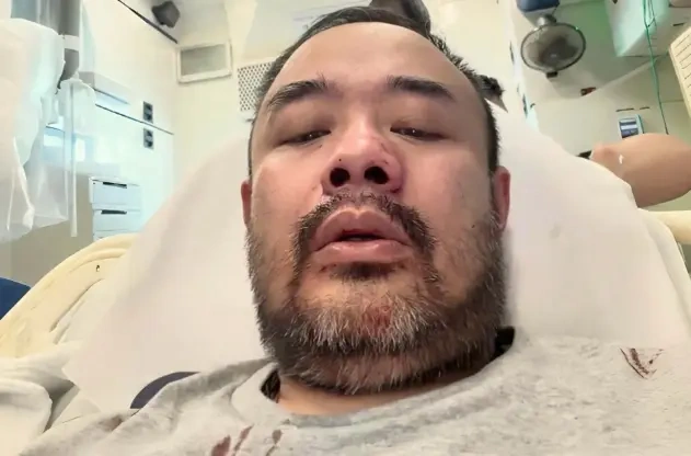 香港男星直播遇袭血流满面，光头男挥拳猛揍，背后牵出娱乐圈恩怨史