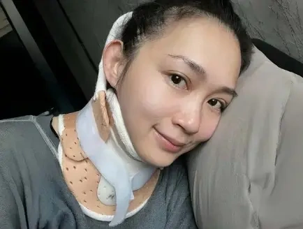 香港知名靓模脖颈严重受伤，玩引体向上凌空坠地